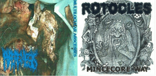 Hyperemesis : Hyperemesis - Rotocles